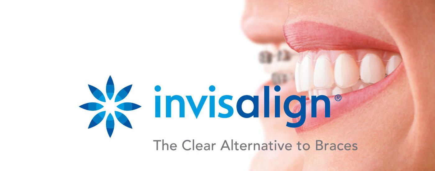 invisalign alta risoluzione.jpg